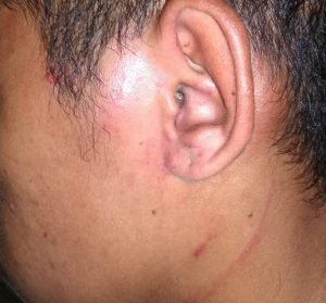 Rianto Mengaku, Dirinya Dianiaya Dan Diintimidasi Oleh Pegawai, Satpol PP Dan Preman