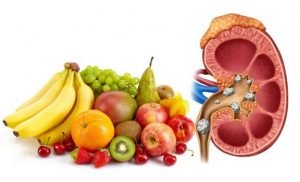 Atasi Batu Ginjal Dengan Konsumsi Tiga Buah Ini