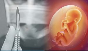 Lakukan Aborsi Mandiri Dua Sejoli Di Mojokerto Terancam Lima Tahun Penjara