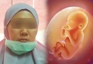 Terungkap, Ini tarif Aborsi Tenaga Kesehatan di Hotel Yang Diamankan