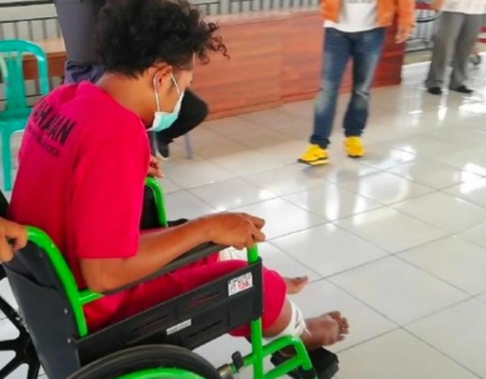 Cerita Jambret Di Pasuruan Bikin Korban Terseret Motor