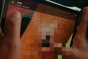 Enam Warga di Tulungagung Diduga Tertular Penyakit Antraks