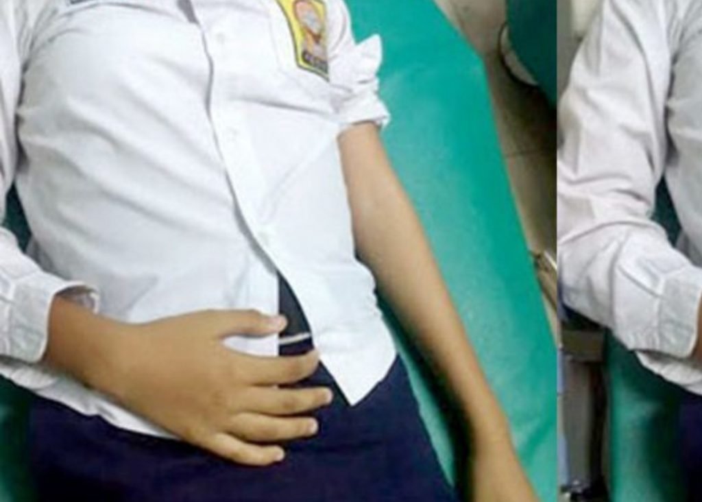 Miris Bocah SMP Di Dlanggu Diperkosa Tetangganya, Kini Tengah Hamil