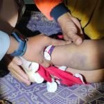 Bocah Perempuan Meninggal Dengan Penuh Luka Memar Diselidiki Polisi
