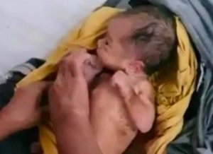 Miris ! Baru Lahir, Bayi Dibuang Di Selokan Dalam Kondisi Hidup