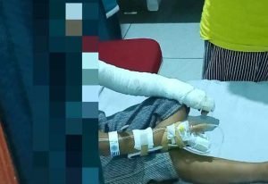 Ledakan Snack yang Memakan Korban di Ponorogo Ternyata Bernama ‘Chiki Kebul’