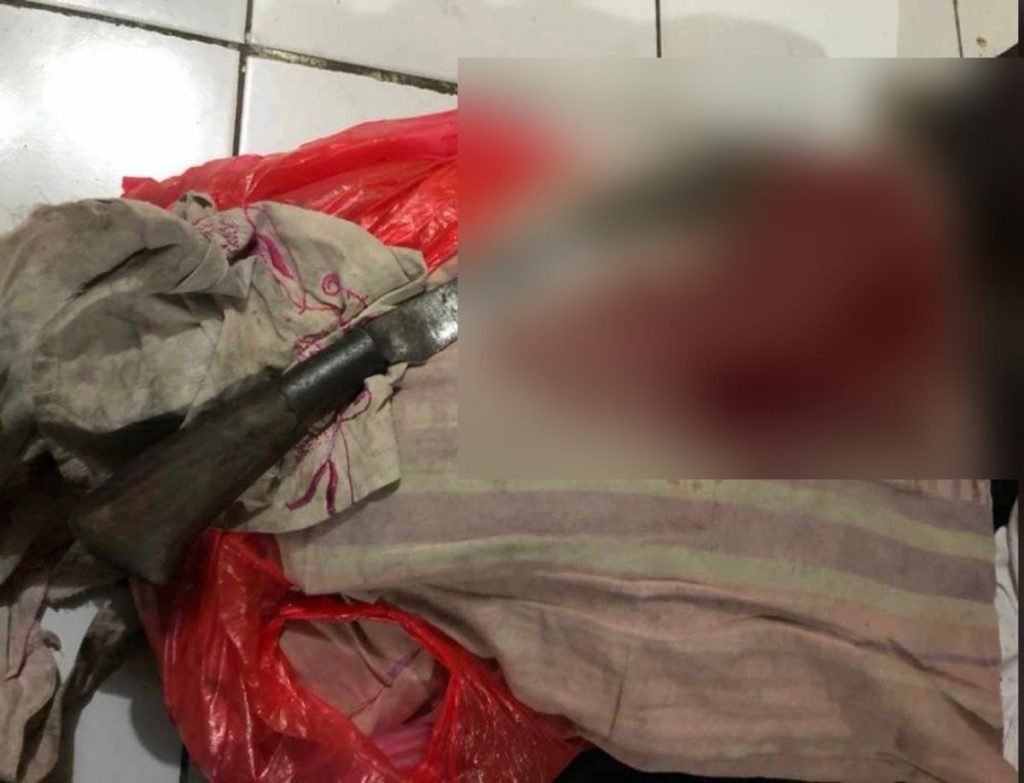 Digorok Anak, Ibu di Jember Jalani Operasi