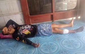 Penjaga Kafe Bacok Pemuda di Situbondo Gegara Blayer Motor