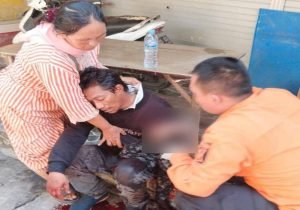 Rebutan Stand Sebabkan Tangan Pria di Surabaya Nyaris Putus Dibacok Saudara