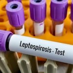 Leptospirosis, Penyakit Kencing tikus