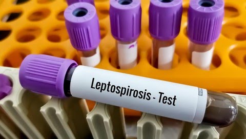 Leptospirosis, Penyakit Kencing tikus