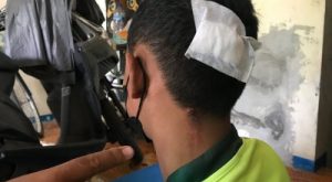 Apes! Remaja di Sidoarjo Dikeroyok Gengster Bersajam Hingga Kepala Bocor