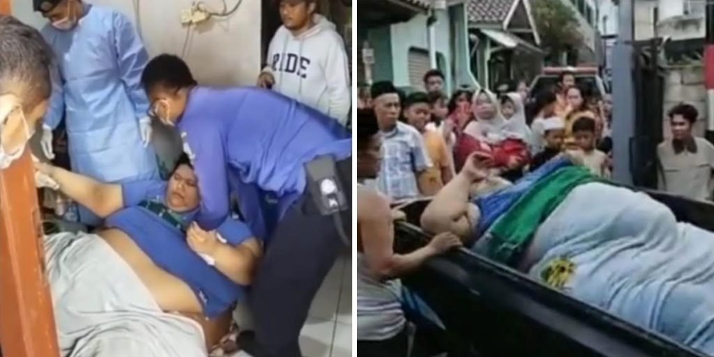 Viral Pria Obesitas di Tangerang, Waspadai Tanda-tandanya