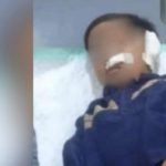 Telinga putus, Bocah pasuruan