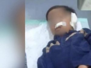 Telinga Bocah Pasuruan Putus Digigit Teman Saat Ngaji