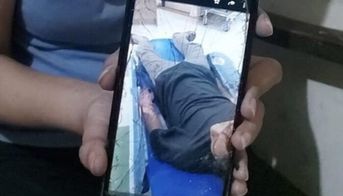 Sepasang Kekasih di Surabaya Jadi Korban Begal, Si Wanita Dibacok