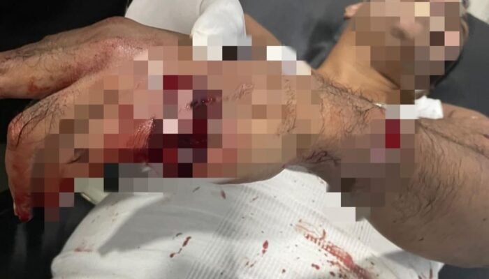 Polsek Ternate Selatan Respon Cepat Laporan Dugaan Penganiayaan Warga Ngade